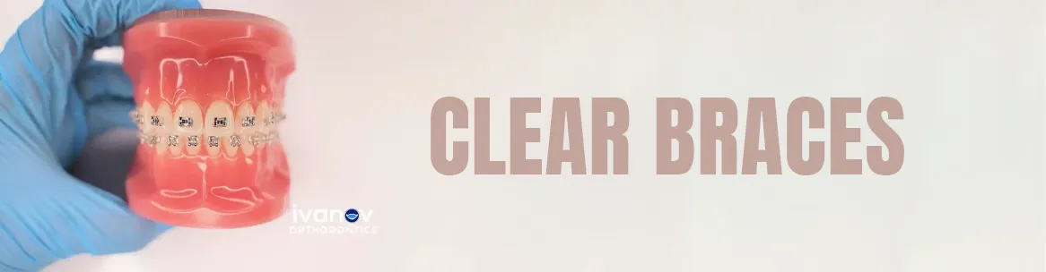 clear-braces clear braces