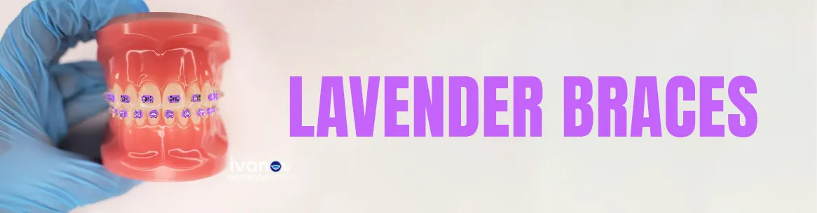 lavender-braces lavender braces