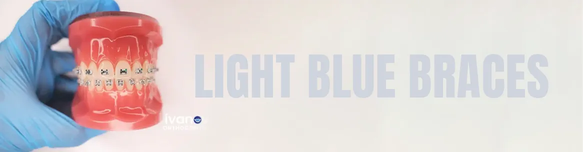 light-blue-braces light blue braces
