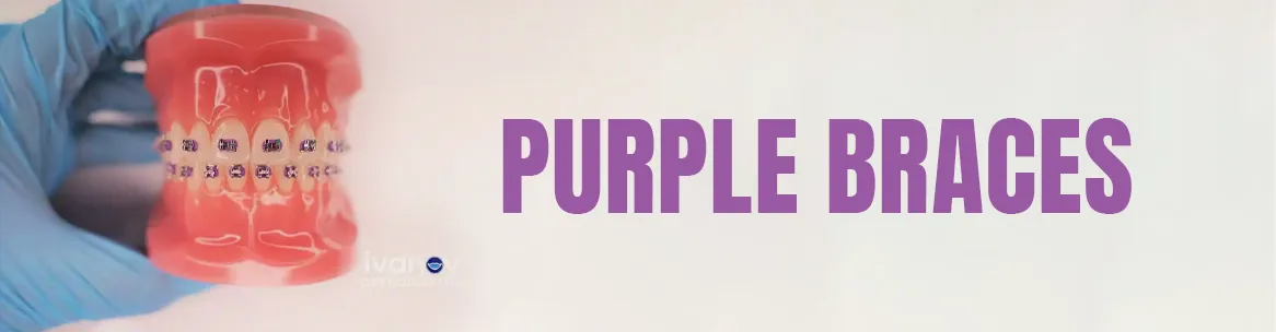 purple-braces purple braces