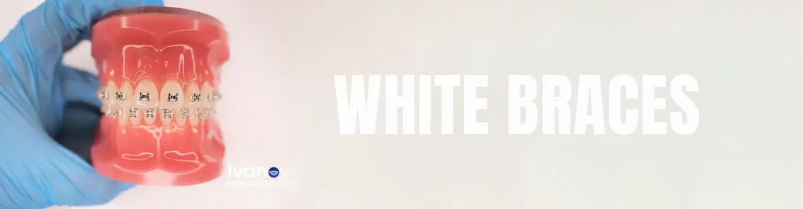 white-braces white braces