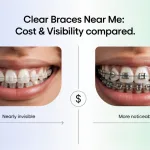 Clear Braces Near Me: Comparing Cost & Visibility In Your Local Area