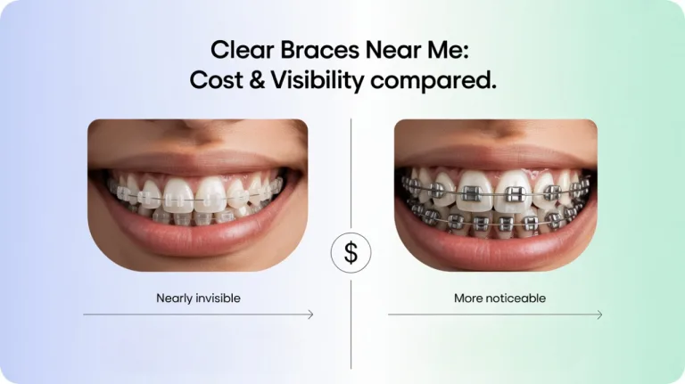 Clear Braces Near Me